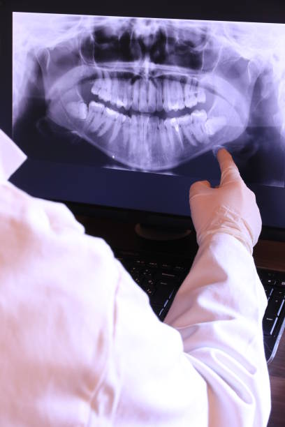 Best Broken or Chipped Tooth Repair in Brookfield, NJ